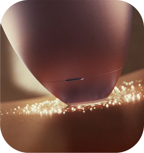 IPL SenseIQ Technology